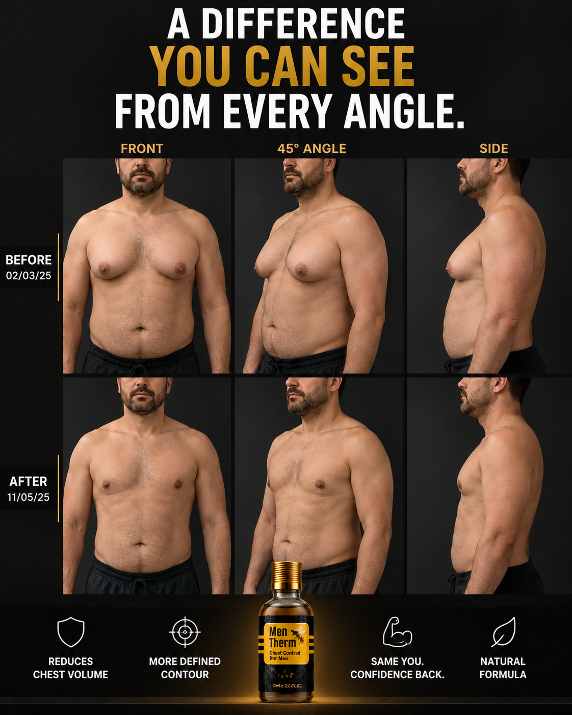 Men Therm - Bee Venom Gynecomastia Heating Oil